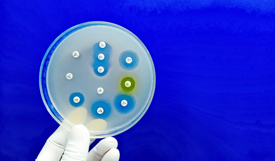 Test auf Antibiotikaresistenzen in einer Petrischale.