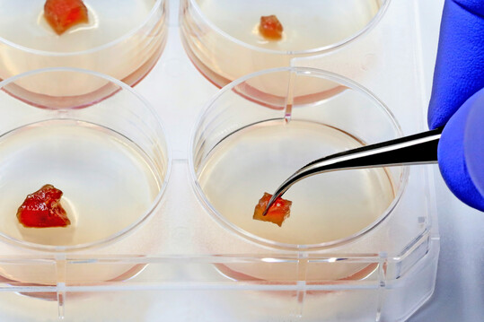 Fleisch aus Zellkulturen, sogenanntes In-vitro-Fleisch, sollte viele Probleme, die die aktuelle Proteinerzeugung mit sich bringt, lsen. 