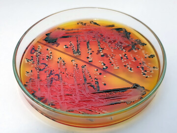 Bakterien knnen sich alle 20 Minuten verdoppeln  hier Salmonella-Bakterien. Um die rasante Vermehrung zu verhindern, sind Hygienemanahmen ein elementarer Bestandteil der landwirtschaftlichen Sorgfaltspflicht. 