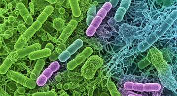 Wie sieht ein normaler, gesunder Darm aus und wie verndert er sich mit zunehmendem Alter der Tiere? Die Entwicklung des Mikrobioms  die bakterielle Gemeinschaft im Geflgeldarm  ist entscheidend fr Darmgesundheit und Produktivitt. 