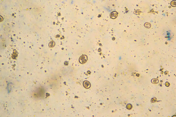 Sporulierte Oozysten von 
<i>Eimeria</i>
 aus infizierten Proben unter dem Mikroskop. Diese widerstandsfhigen Entwicklungsstadien sind fr die Ansteckung von Geflgel entscheidend. Forschung und Praxis arbeiten daran, durch Ftterungs- und Managementmanahmen die Ausbreitung dieser Entwicklungsformen einzudmmen.