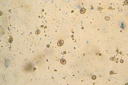 Sporulierte Oozysten von 
<i>Eimeria</i>
 aus infizierten Proben unter dem Mikroskop. Diese widerstandsfhigen Entwicklungsstadien sind fr die Ansteckung von Geflgel entscheidend. Forschung und Praxis arbeiten daran, durch Ftterungs- und Managementmanahmen die Ausbreitung dieser Entwicklungsformen einzudmmen.