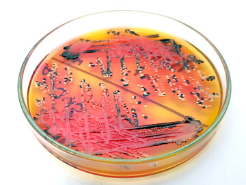 Mit einer gezielten Reinigung und Desinfektion lassen sich Viren, Bakterien, Pilze und Parasiten bek�mpfen. Wichtig ist dabei, die Zielobjekte, wie hier beispielsweise Salmonellen, zu kennen. 