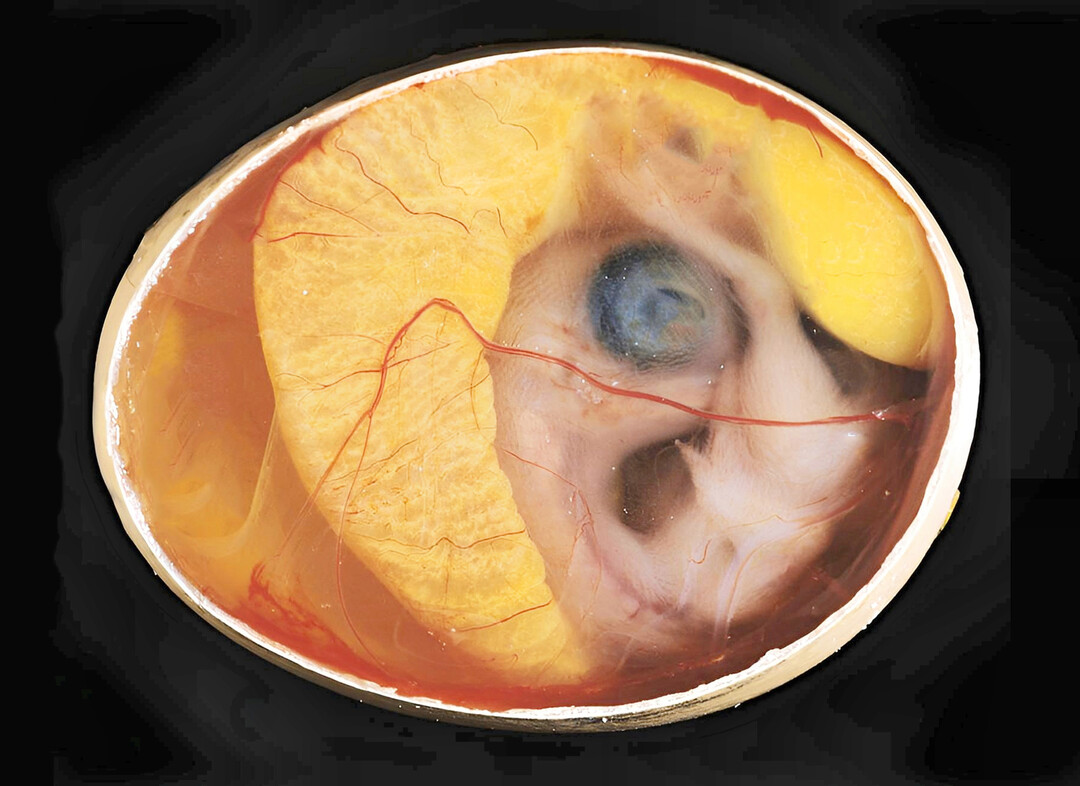 Die Bildung des Eis im Eileiter verl�uft offenbar nicht steril. Bestimmte Bakterien �berstehen die Passage und k�nnten so bereits vor dem Schlupf in Kontakt mit dem Embryo kommen.