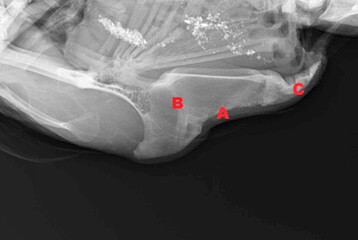 Deformationen, traumatische und nicht traumatische Frakturen knnen sowohl isoliert als auch, wie auf dieser Rntgenaufnahme zu sehen, gemeinsam auftreten.A = Deformation, B = traumatische Fraktur, C = zahlreiche Frakturen im hinteren Brustbeindrittel, vermutlich nicht traumatisch