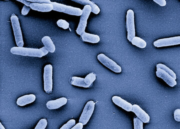 Bei Bakterien der Gattung Salmonella ist HIRI-Forschern erstmals die RNA-Einzelzellsequenzierung gelungen 