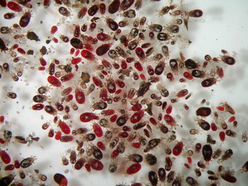  Rote Vogelmilbe unter dem Mikroskop: Die Frbung des etwa 0,7 x 0,4 mm groen Blutsaugers variiert von weilich-grau bis dunkelrot-braun  je nach aufgenommener Blutmenge. 